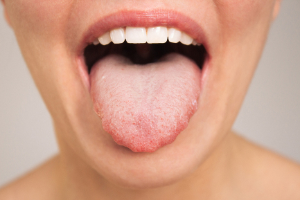 Читать статью Бактерия из полости рта провоцирует агрессивный рак кишечника