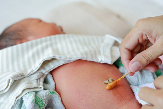 Читать статью Безопасный уход за пупочной ранкой у новорождённого