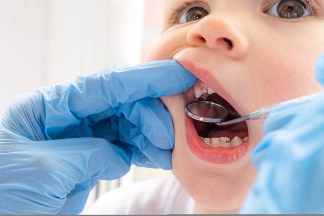 Причины возникновения гниения детских зубов