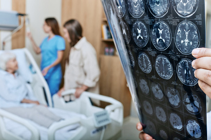 Читать статью "Лечение инсульта тромболизисом"