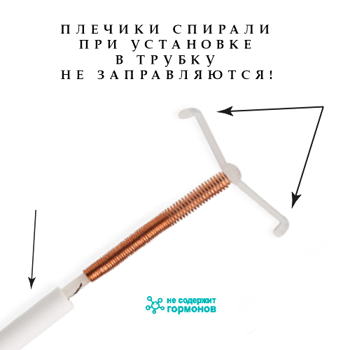 Вектор-экстра контрацептив внутриматочный золотосодержащий т-образный au 300 т