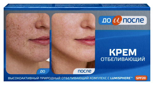 До и после крем отбеливающий 100 мл
