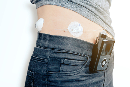 Читать статью "Москвичам с диабетом станет проще получать расходники для инсулиновой помпы"