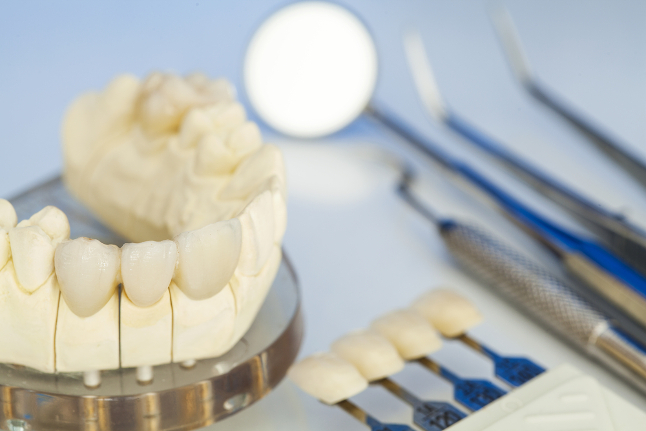 Отторжение зубов после имплантации, симптомы и причины