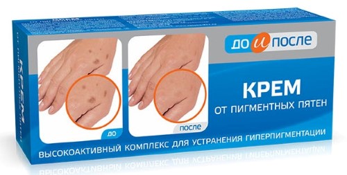 Изображение товара До и после крем от пигментных пятен 50 мл