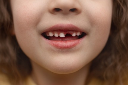Рот маленькой девочки с выпавшим зубом.