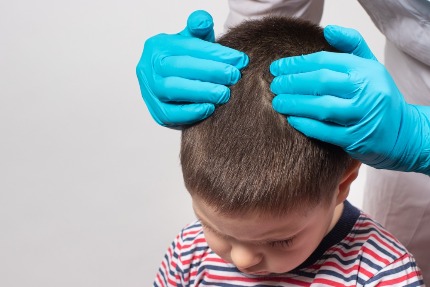 Что делать, если ваш ребенок выдергивает волосы из головы | Матери сегодня