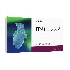 Купить Транидаб 150 мг 30 шт. капсулы цена