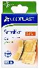 Купить Ecoplast пластырь медицинский нетканый (набор) sensitive 16 шт. цена
