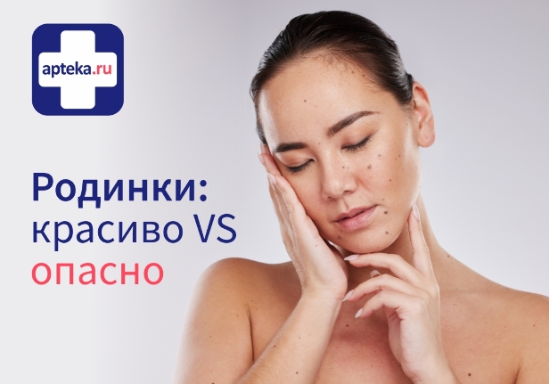 Читать статью Родинки: что это такое?