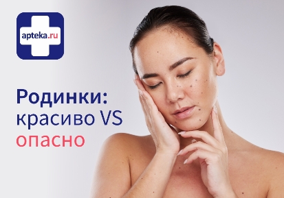 Читать статью "Родинки: что это такое?"