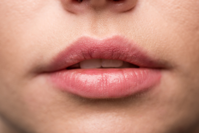 Как вылеччить обветренные губы - 5 факторов, которые могут усугубить ситуацию | OkBeauty