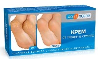 Изображение товара До и после крем от трещин в ступнях 150 мл