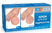 Изображение товара До и после крем гидроактив для рук 100 мл