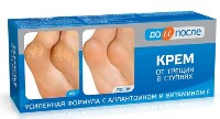 Изображение товара До и после крем от трещин в ступнях 50 мл