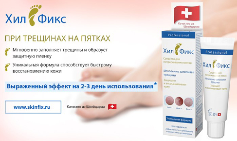 Читать статью "Трещины на пальцах рук и пятках: что поможет?"
